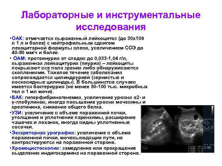 Лабораторные и инструментальные исследования • ОАК: отмечается выраженный лейкоцитоз (до 30 х109 в 1