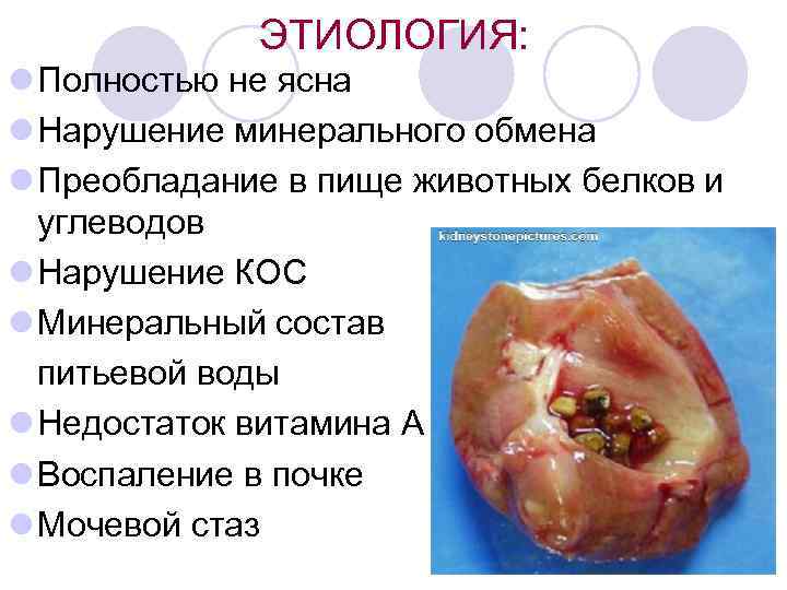 ЭТИОЛОГИЯ: l Полностью не ясна l Нарушение минерального обмена l Преобладание в пище животных