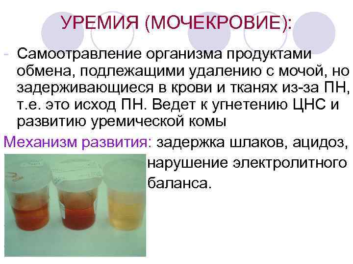 УРЕМИЯ (МОЧЕКРОВИЕ): - Самоотравление организма продуктами обмена, подлежащими удалению с мочой, но задерживающиеся в