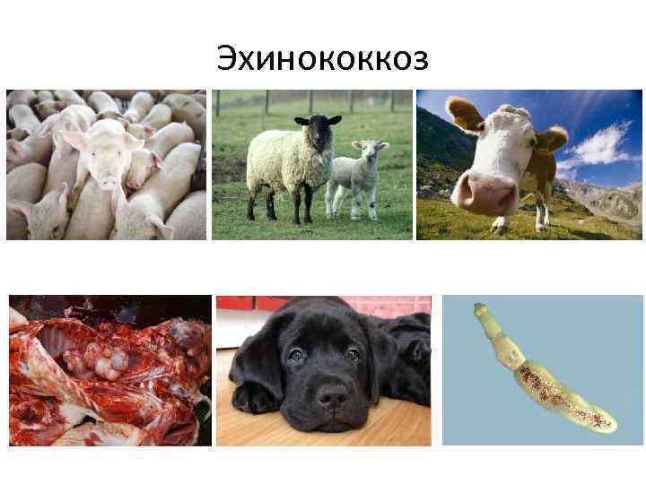 Эхинококкоз 