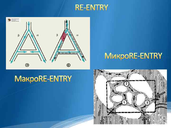 RE-ENTRY Микро. RE-ENTRY Макро. RE-ENTRY 