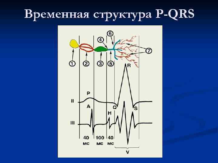 Временная структура P-QRS 