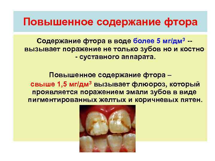 Длительный избыток фтора в организме может привести. Содержание фтора в воде. Повышенное содержание фтора.