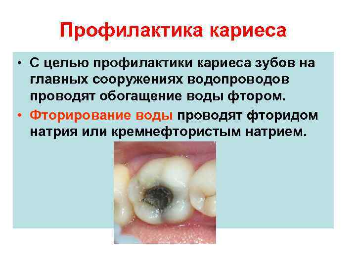 Профилактика кариеса • С целью профилактики кариеса зубов на главных сооружениях водопроводов проводят обогащение