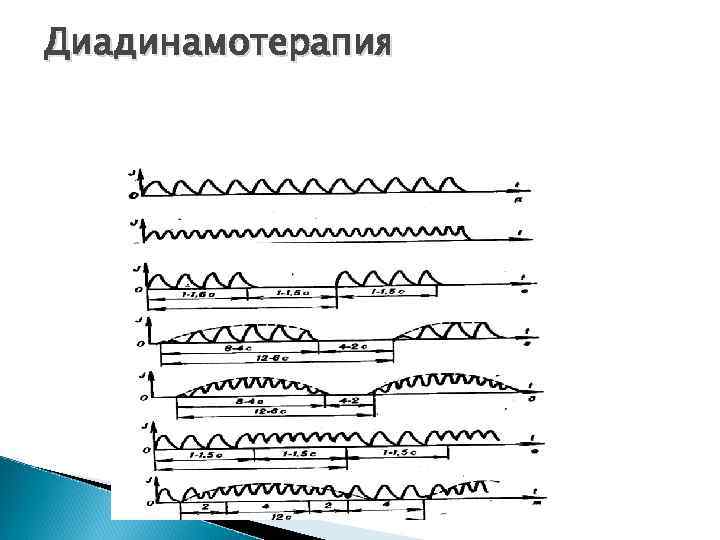 Диадинамотерапия 