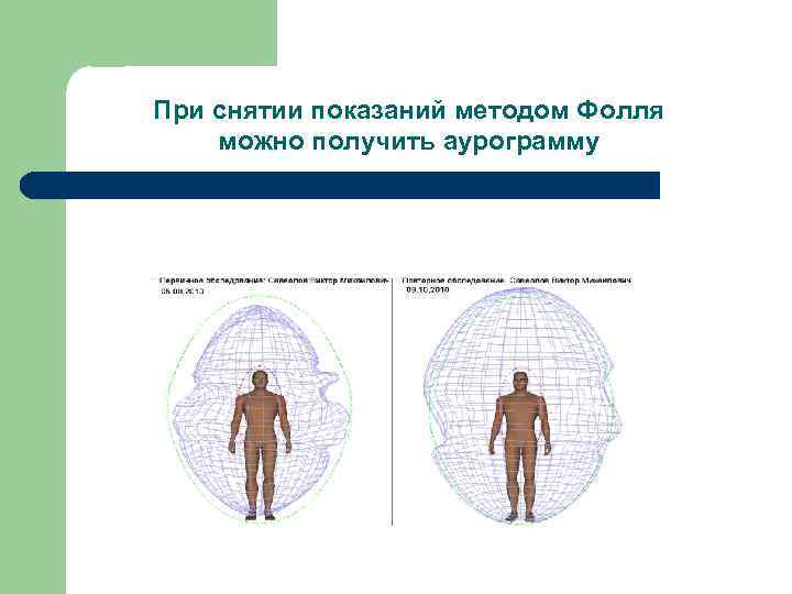 При снятии показаний методом Фолля можно получить аурограмму 