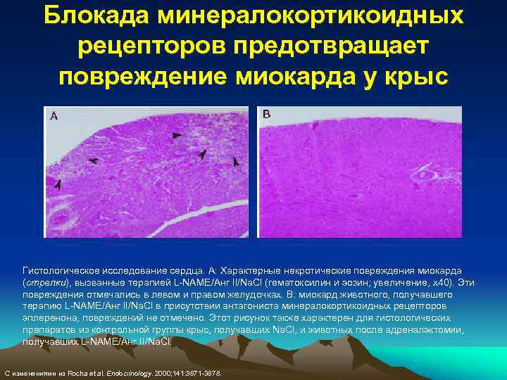 Блокада минералокортикоидных рецепторов предотвращает повреждение миокарда у крыс Гистологическое исследование сердца. A: Характерные некротические