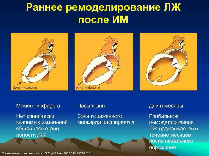 Раннее ремоделирование ЛЖ после ИМ Зона инфаркта Момент инфаркта Часы и дни Дни и