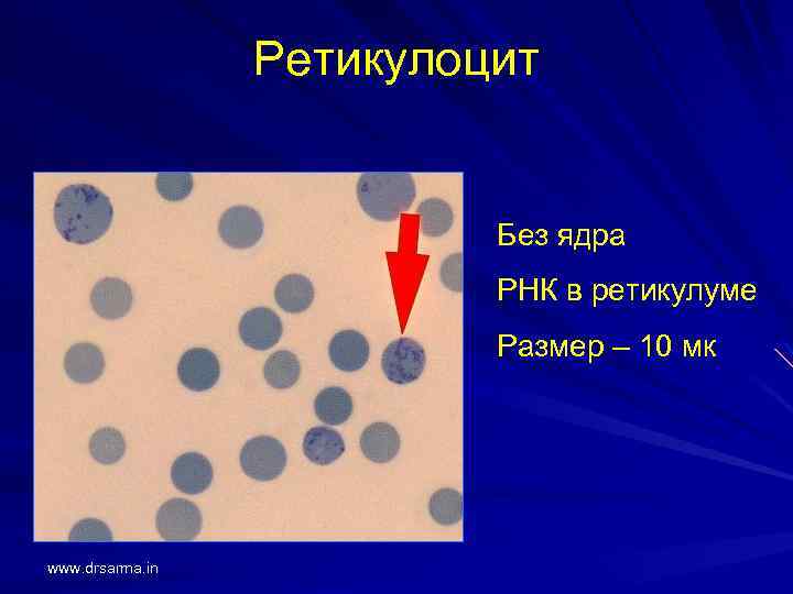 Ретикулоциты в мазке фото