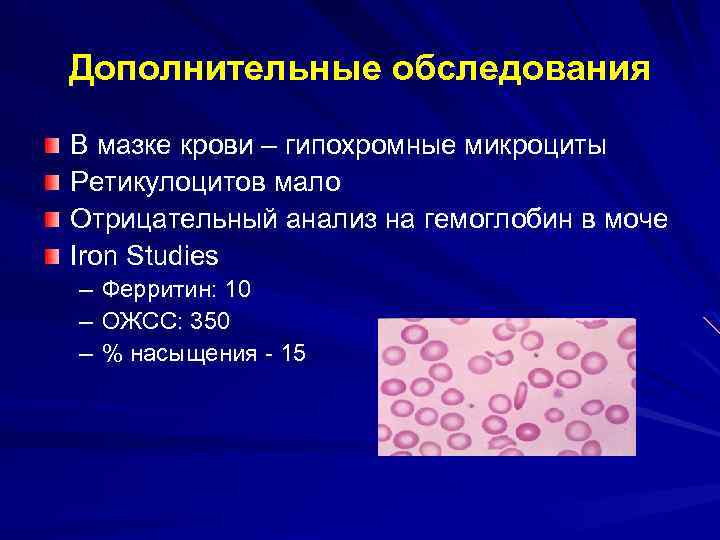 Дополнительные обследования В мазке крови – гипохромные микроциты Ретикулоцитов мало Отрицательный анализ на гемоглобин