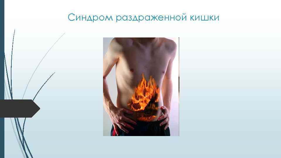 Синдром раздраженной кишки 