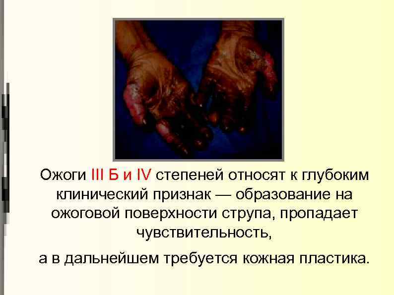 Ожоги III Б и IV степеней относят к глубоким клинический признак — образование на