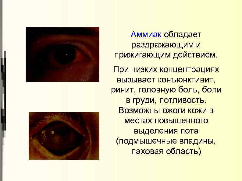 Аммиак обладает раздражающим и прижигающим действием. При низких концентрациях вызывает конъюнктивит, ринит, головную боль,