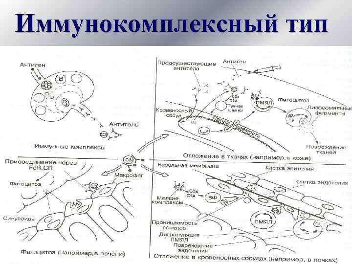 Иммунокомплексный тип 