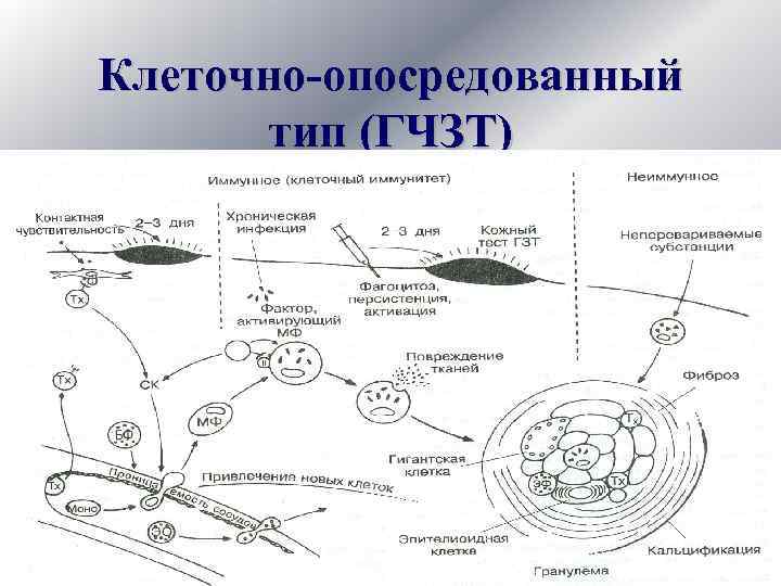 Клеточно-опосредованный тип (ГЧЗТ) 