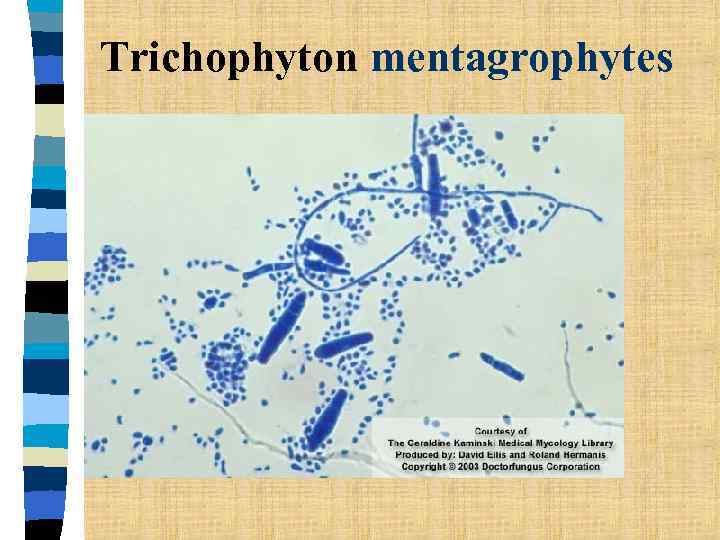 Trichophyton mentagrophytes 