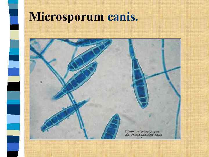 Microsporum canis. 