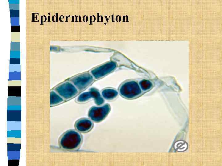 Epidermophyton 