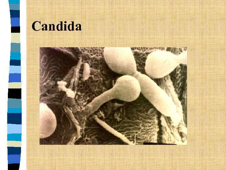 Candida 