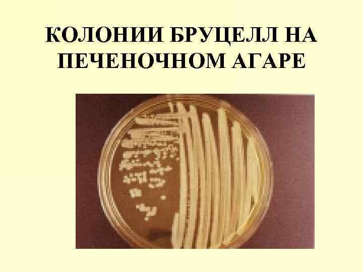 КОЛОНИИ БРУЦЕЛЛ НА ПЕЧЕНОЧНОМ АГАРЕ 