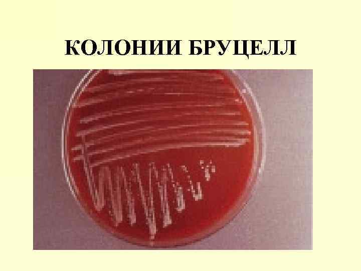 Бруцеллы микробиология презентация