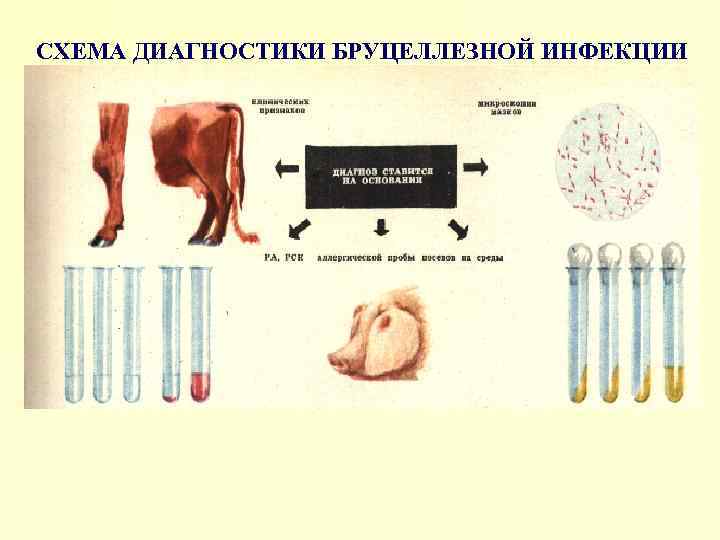 СХЕМА ДИАГНОСТИКИ БРУЦЕЛЛЕЗНОЙ ИНФЕКЦИИ 