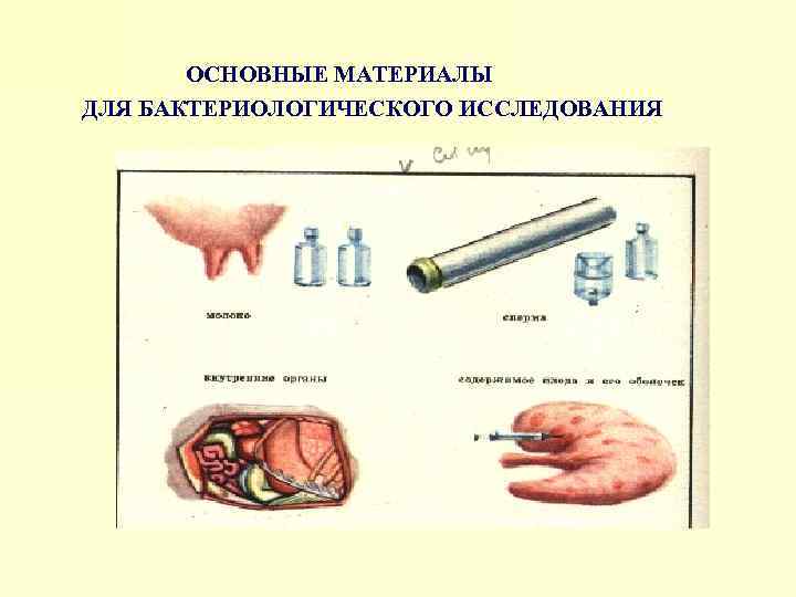 ОСНОВНЫЕ МАТЕРИАЛЫ ДЛЯ БАКТЕРИОЛОГИЧЕСКОГО ИССЛЕДОВАНИЯ 