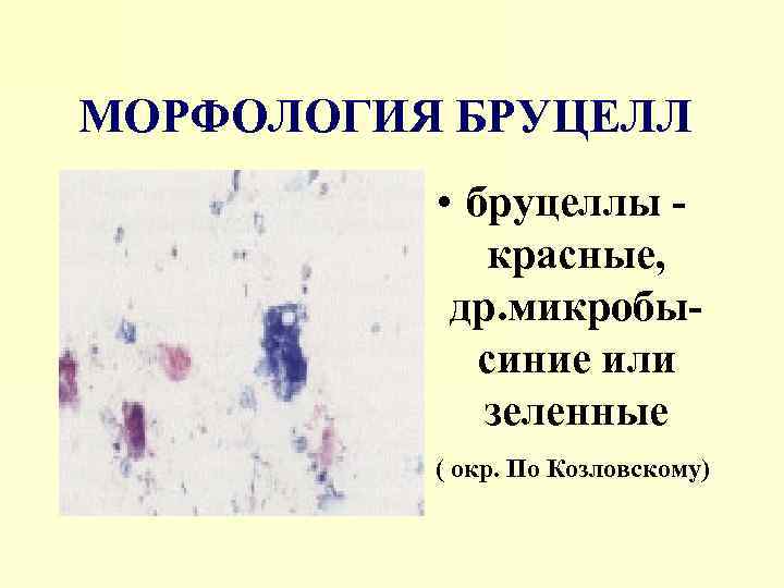 МОРФОЛОГИЯ БРУЦЕЛЛ • бруцеллы красные, др. микробысиние или зеленные • ( окр. По Козловскому)