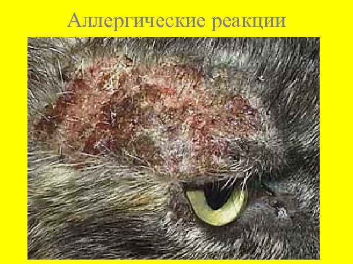 Аллергические реакции 