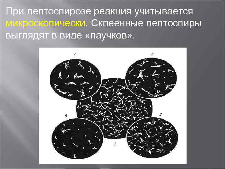 При лептоспирозе реакция учитывается микроскопически. Склеенные лептоспиры выглядят в виде «паучков» . 