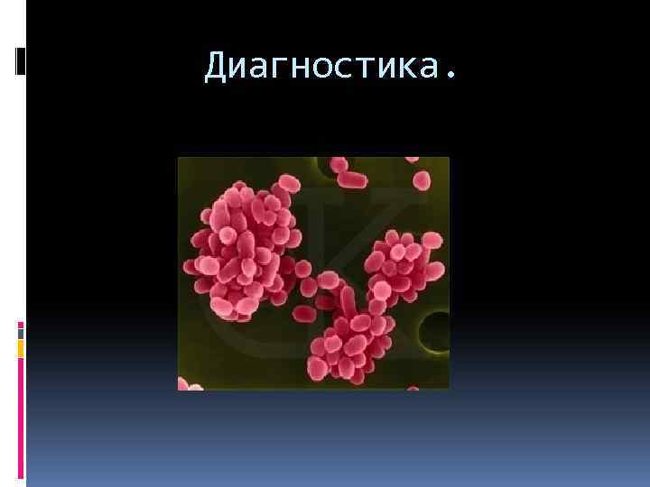 Диагностика. 