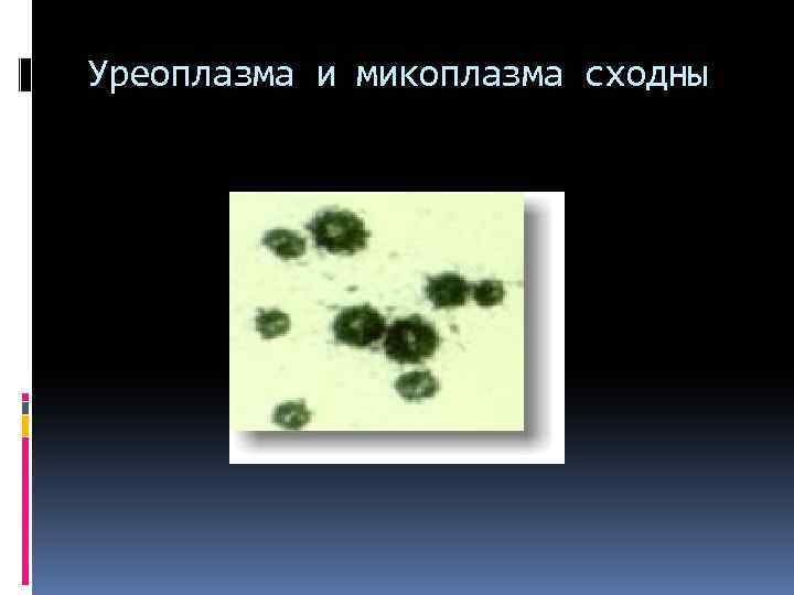 Уреоплазма и микоплазма сходны 