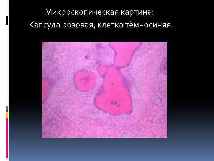  Микроскопическая картина: Капсула розовая, клетка тёмносиняя. 