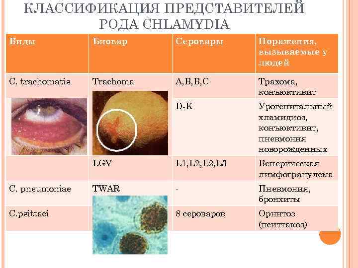 КЛАССИФИКАЦИЯ ПРЕДСТАВИТЕЛЕЙ РОДА CHLAMYDIA Виды Биовар Серовары Поражения, вызываемые у людей C. trachomatis Trachoma