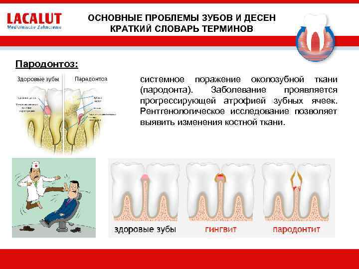 ОСНОВНЫЕ ПРОБЛЕМЫ ЗУБОВ И ДЕСЕН КРАТКИЙ СЛОВАРЬ ТЕРМИНОВ Пародонтоз: системное поражение околозубной ткани (пародонта).