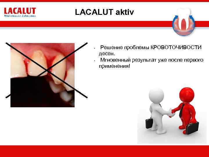 LACALUT aktiv • • Решение проблемы КРОВОТОЧИВОСТИ десен. Мгновенный результат уже после первого применения!