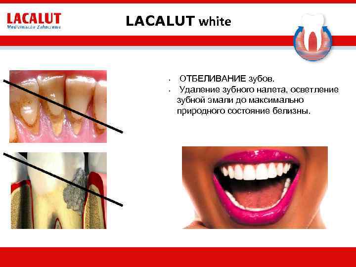 LACALUT white • • ОТБЕЛИВАНИЕ зубов. Удаление зубного налета, осветление зубной эмали до максимально