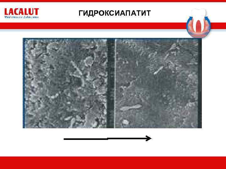 ГИДРОКСИАПАТИТ 