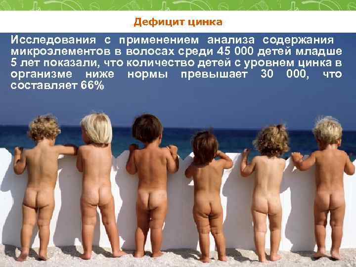 Дефицит цинка Исследования с применением анализа содержания микроэлементов в волосах среди 45 000 детей
