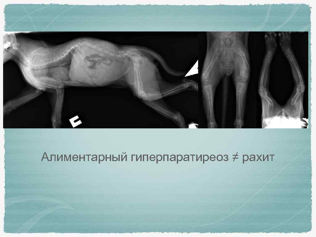 Алиментарный гиперпаратиреоз ≠ рахит 