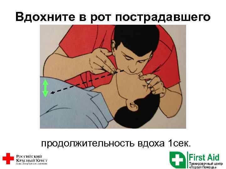 Вдохните в рот пострадавшего продолжительность вдоха 1 сек. 