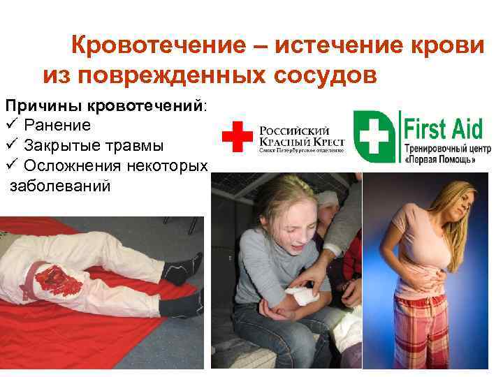  Кровотечение – истечение крови из поврежденных сосудов Причины кровотечений: ü Ранение ü Закрытые