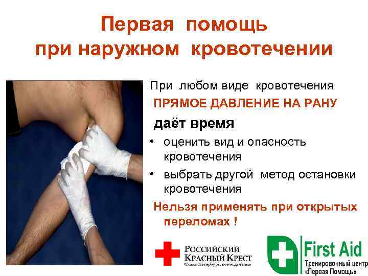 Первая помощь при наружном кровотечении При любом виде кровотечения ПРЯМОЕ ДАВЛЕНИЕ НА РАНУ даёт