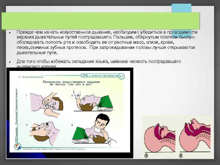  Прежде чем начать искусственное дыхание, необходимо убедиться в проходимости верхних дыхательных путей пострадавшего.