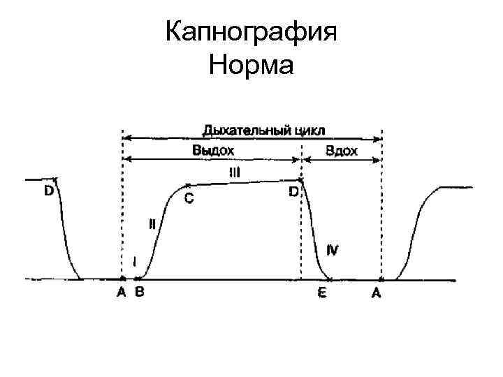 Капнография Норма 