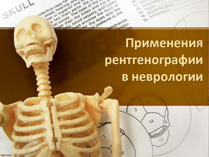 Применения рентгенографии в неврологии 