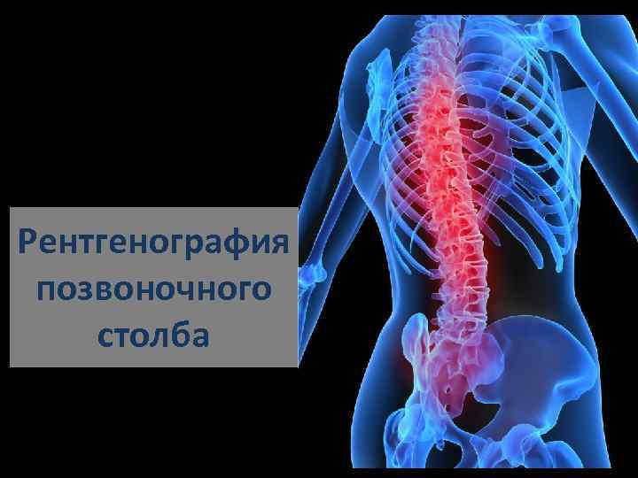 Рентгенография позвоночного столба 