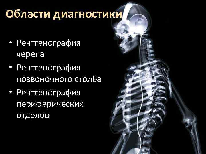 Области диагностики • Рентгенография черепа • Рентгенография позвоночного столба • Рентгенография периферических отделов 
