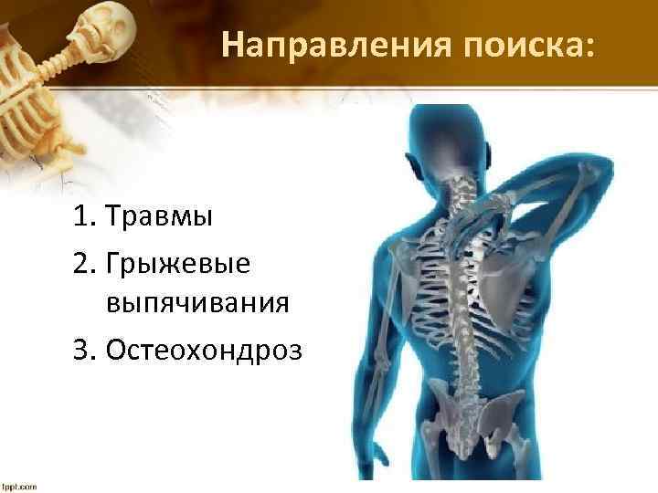 Направления поиска: 1. Травмы 2. Грыжевые выпячивания 3. Остеохондроз 
