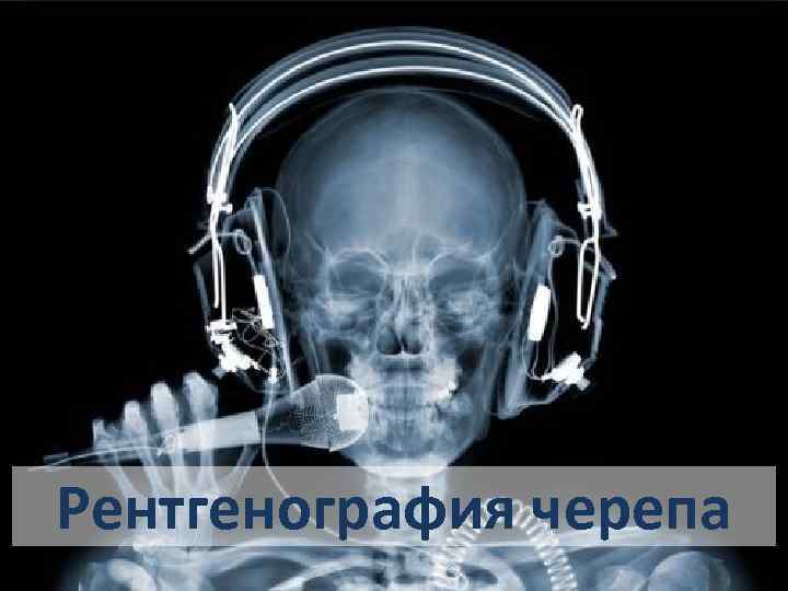 Рентгенография черепа 